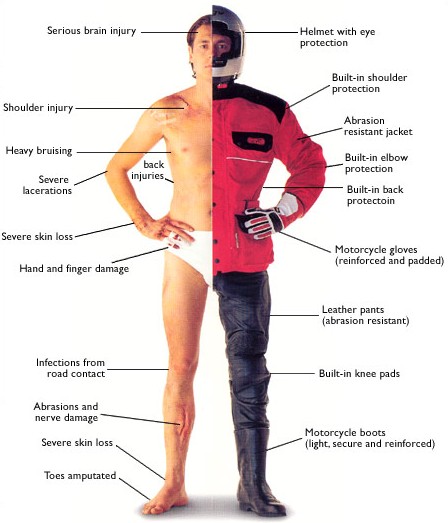 Motorcycle injuries